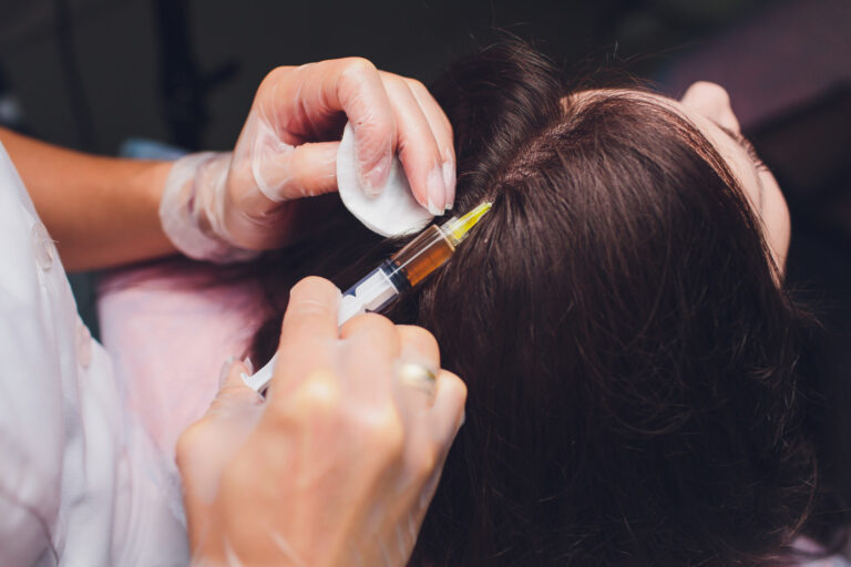 PRP vs Other Hair Loss Treatments