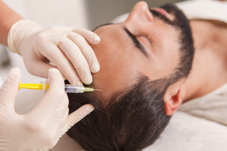 PRP hair treatment