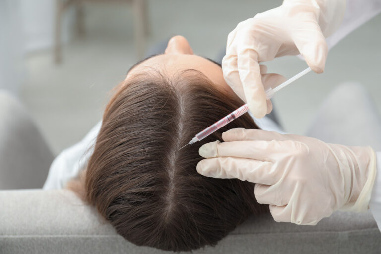 PRP hair treatment