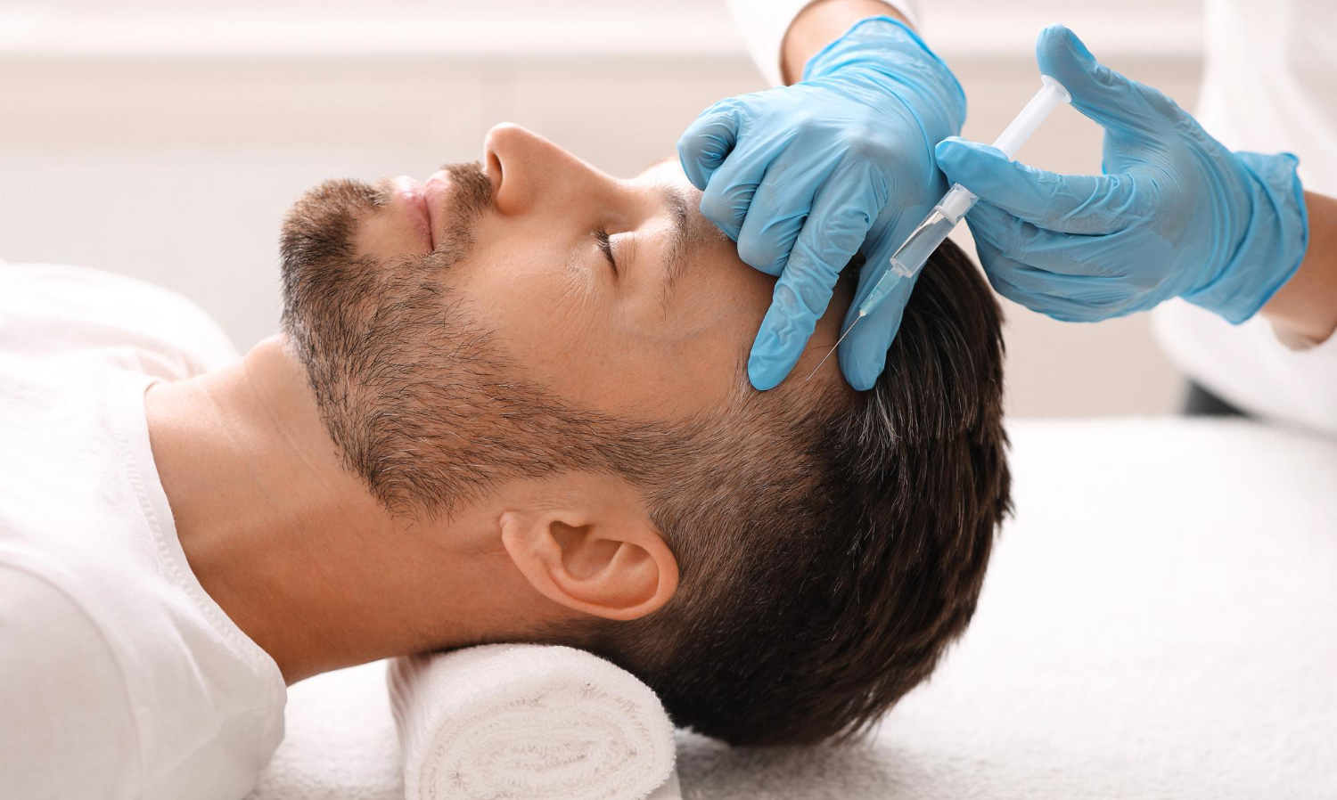 PRP vs Other Hair Loss Treatments
