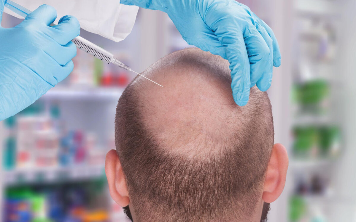 Hair Transplant Clinic