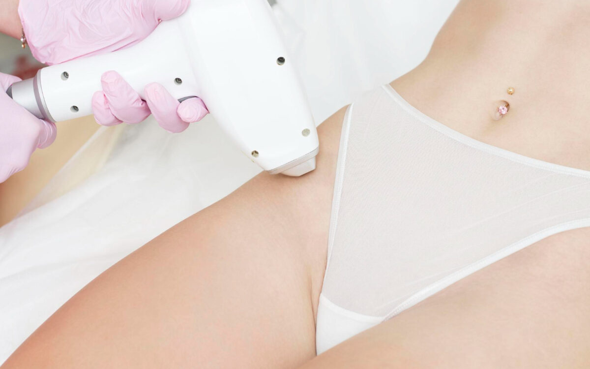 Laser Hair Removal for Bikini Area