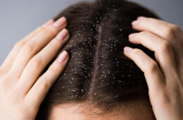 Oily Dandruff vs Dry Dandruff: Key Differences, Causes & Best Treatments