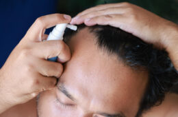 Redensyl vs Minoxidil: Which Is Better for Hair Growth?