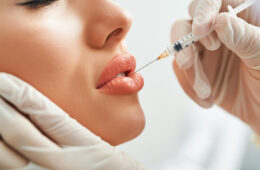 Lip Fillers Explained: What to Expect Before, During & After the Procedure