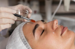 Chemical Peels for Hyperpigmentation: Best Solutions to Remove Dark Spots Effectively